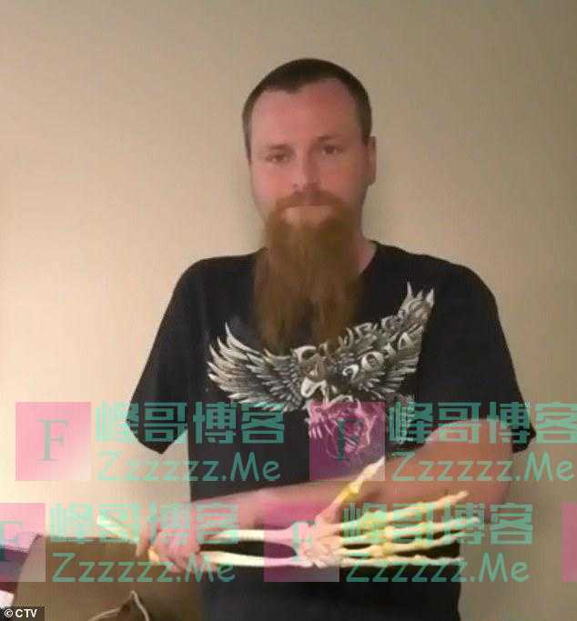 加男子不忍舍弃截肢手臂，通过数百只虫子将截肢剥成标本永存家中