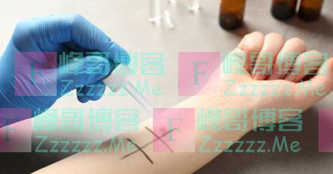 为何我国注射青霉素一定要做“皮试”，而欧美国家却不？