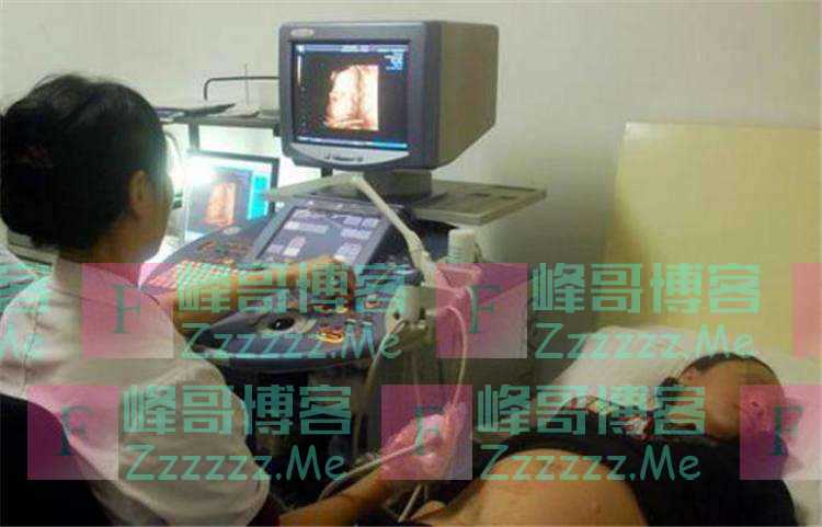 做B超时看见胎儿正在做鬼脸，准爸妈正乐呵着，医生：打掉吧