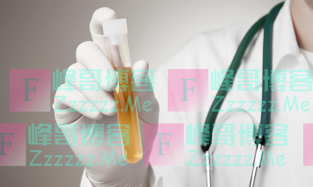 尿黄“异味”重就是上火？或是肾脏发出的“警告”，男性别忽略！