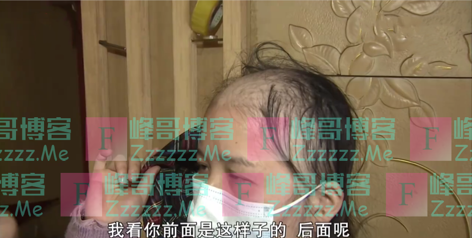我头发呢？女子做完养发后秀发掉光变成了“裘千尺”！