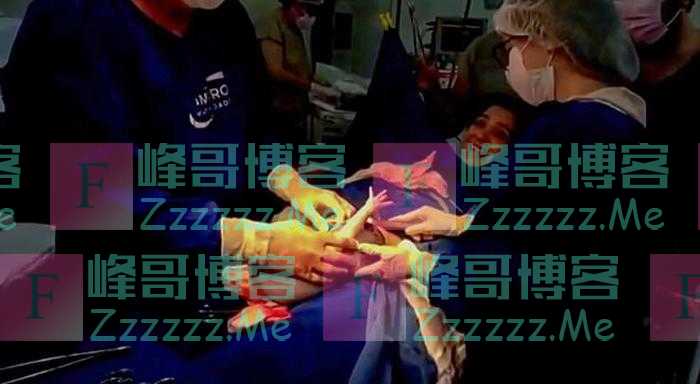巴西一女婴出生时用小手戳破羊膜囊 神奇一幕被拍下
