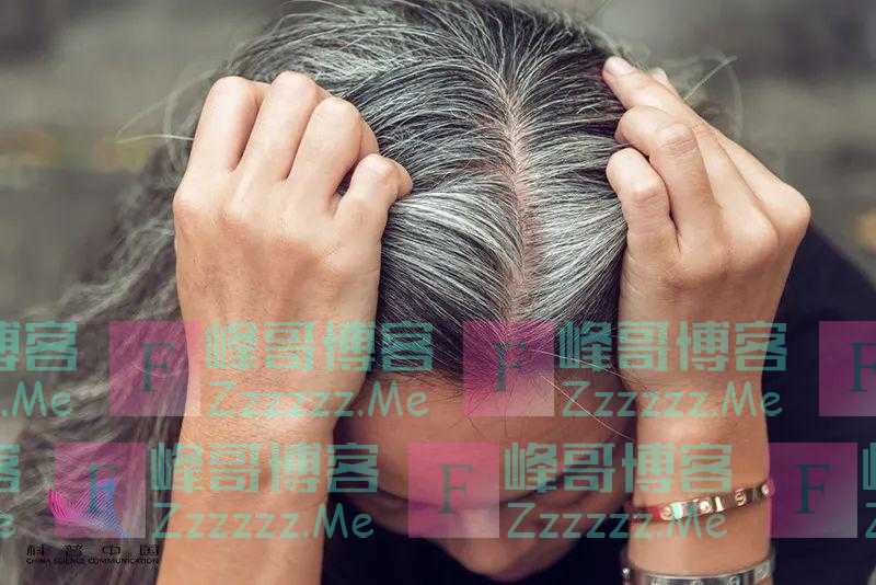 为什么压力大时会长白头发？这些情况要注意！