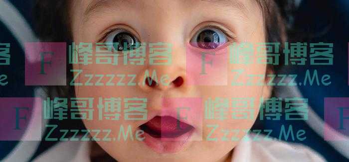 研究:家庭贫富改变婴儿大脑