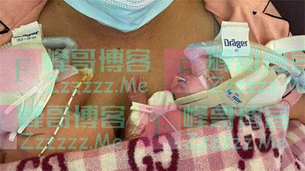 怀孕22周零5天 女子早产生下1斤重双胞胎