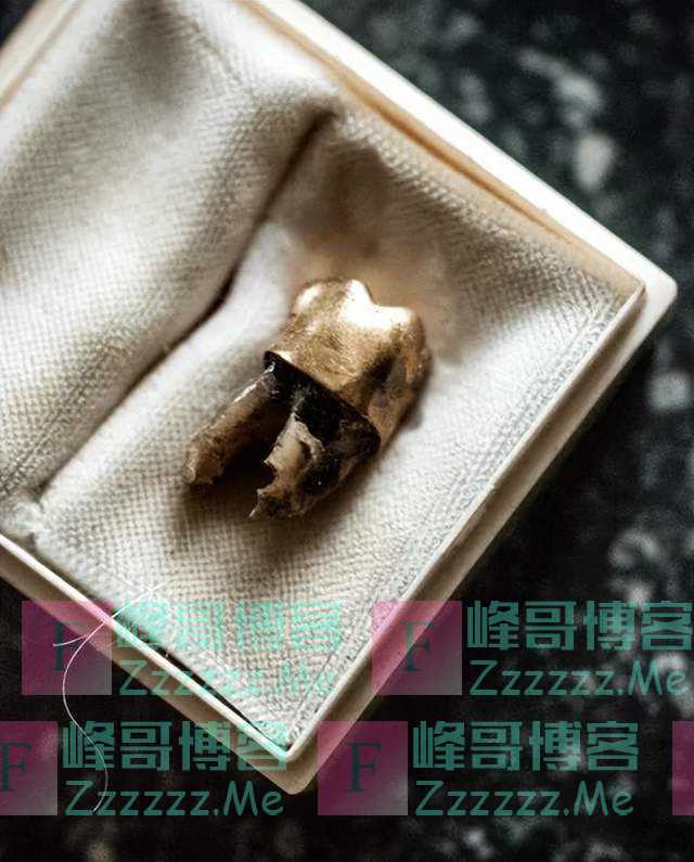 这颗牙齿，终于还了！