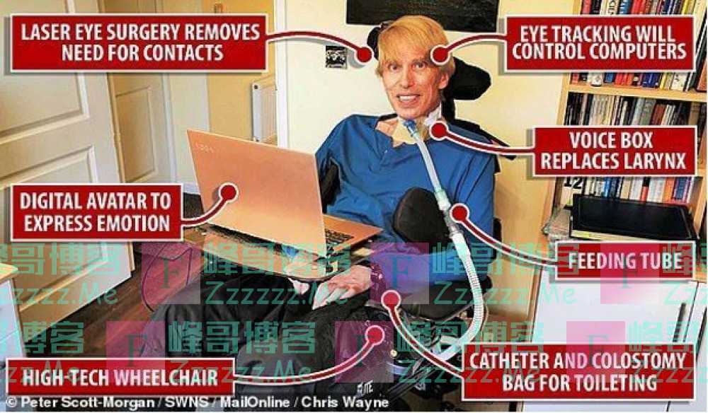 全球首位“赛博格”平静辞世 人类离机器人究竟有多远?