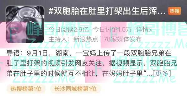 双胞胎肚里打架出生后浑身淤青？产科医生：都不在一个“房间”