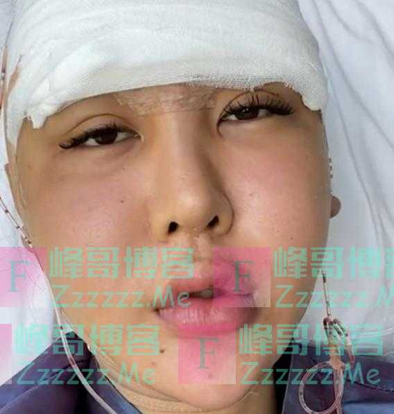 沉迷整容的5大土豪网红:花百万整成真芭比,2年整容300次?