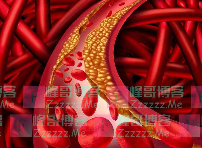 甘油三酯偏高的人,3种“素食”尽量少吃,或会升高血脂