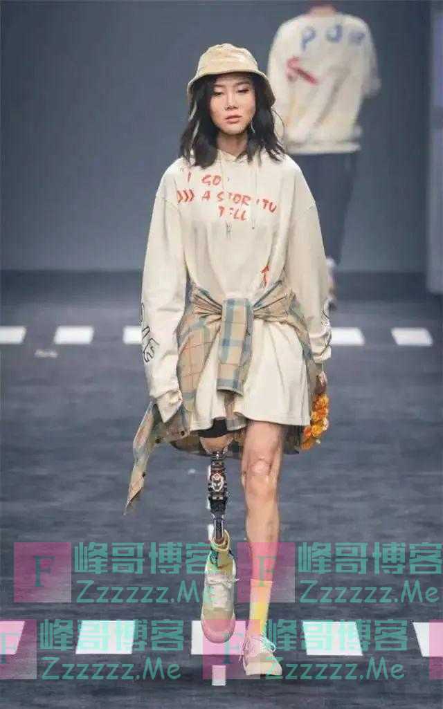 汶川“钢腿女孩”遭网暴,有的私信极其恶毒!四川残联回应!