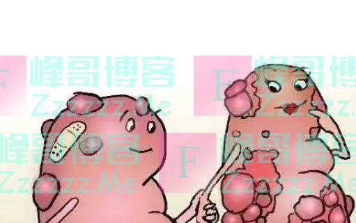 白萝卜是结节“加速器”?消化科医生:不想结节癌变,或少吃4物