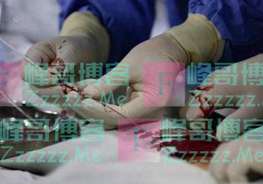 装上心脏支架后，还能活多少年呢？医生不再隐瞒，请提前告诉家人