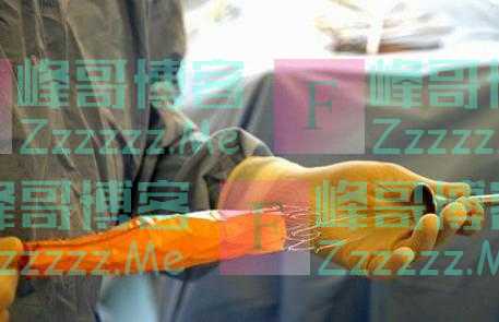 装上心脏支架后，还能活多少年呢？医生不再隐瞒，请提前告诉家人