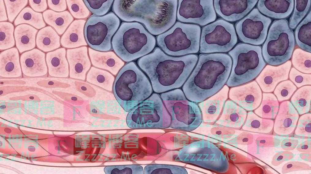 从“炎症”到“癌症”需要用多久?提醒:4种炎症尽量不要拖延