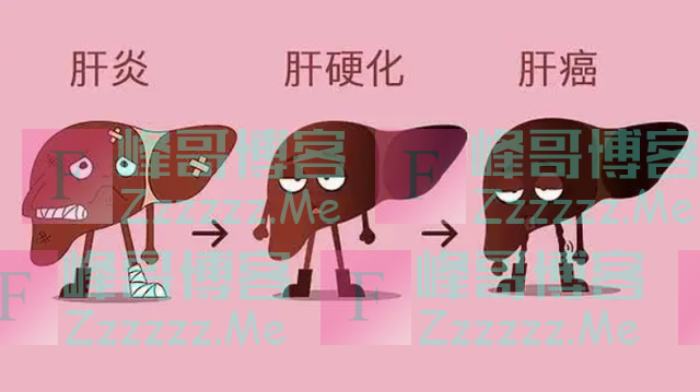 从“炎症”到“癌症”需要用多久?提醒:4种炎症尽量不要拖延