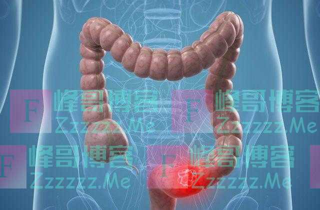 从“炎症”到“癌症”需要用多久?提醒:4种炎症尽量不要拖延