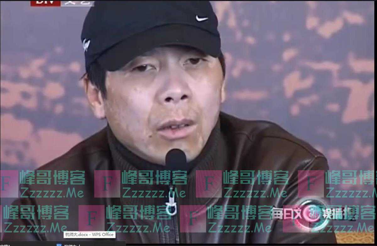 65岁冯小刚白癜风被传不药而愈，皮肤科专家：自愈可能性不大，可能是化妆