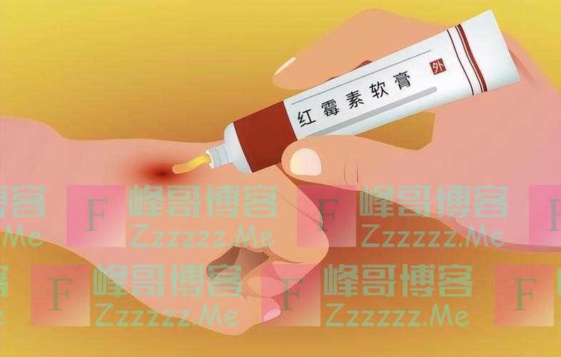 为何有些人满脸“老年斑”,有的却干干净净呢?医生说出实情
