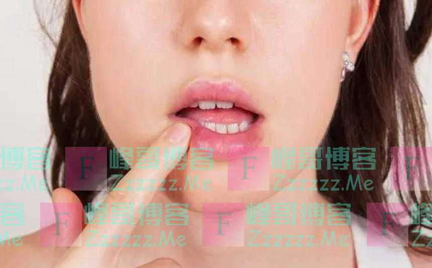 花生是糖尿病“导火索”?医生:若想胰岛强壮,2种食物尽量少吃