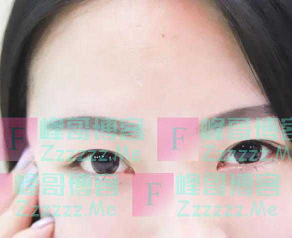 为什么有的女性体毛旺盛，有的却“光秃秃”呢？医生讲出大实话