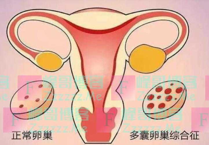 为什么有的女性体毛旺盛，有的却“光秃秃”呢？医生讲出大实话
