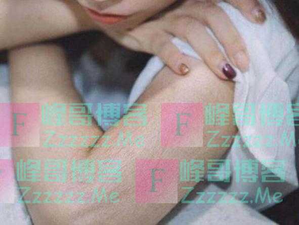 为什么有的女性体毛旺盛，有的却“光秃秃”呢？医生讲出大实话