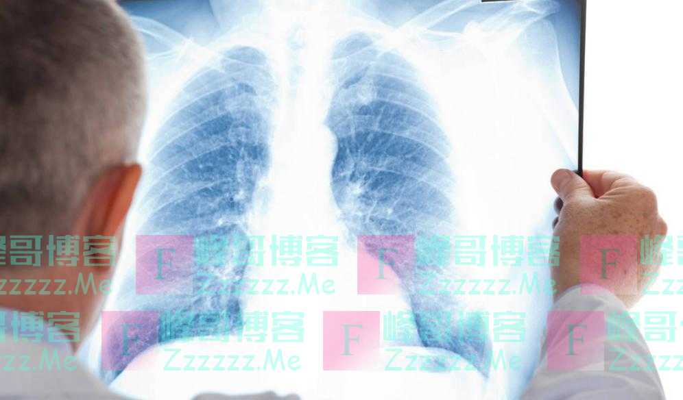 肺部有癌，睡眠先知？睡觉若出现4种异常，或要警惕起来