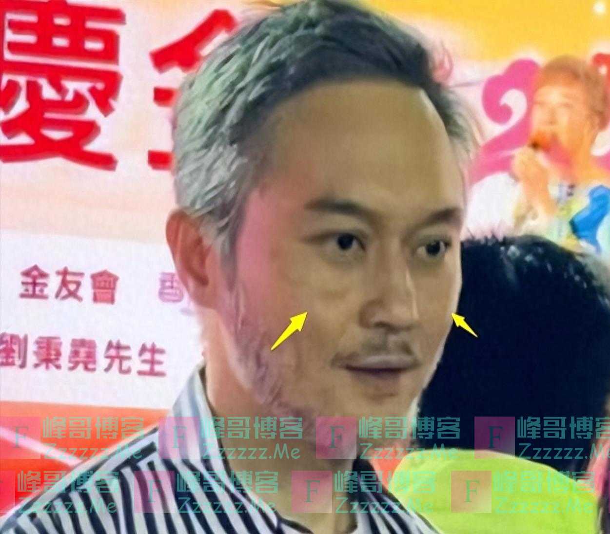 52岁张智霖出警局后首现身，头发花白、老人斑明显，全程无交流