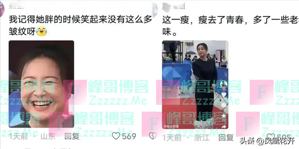 狂减100斤的贾玲后遗症来了:满脸褶子老了30岁,网友直呼太吓人