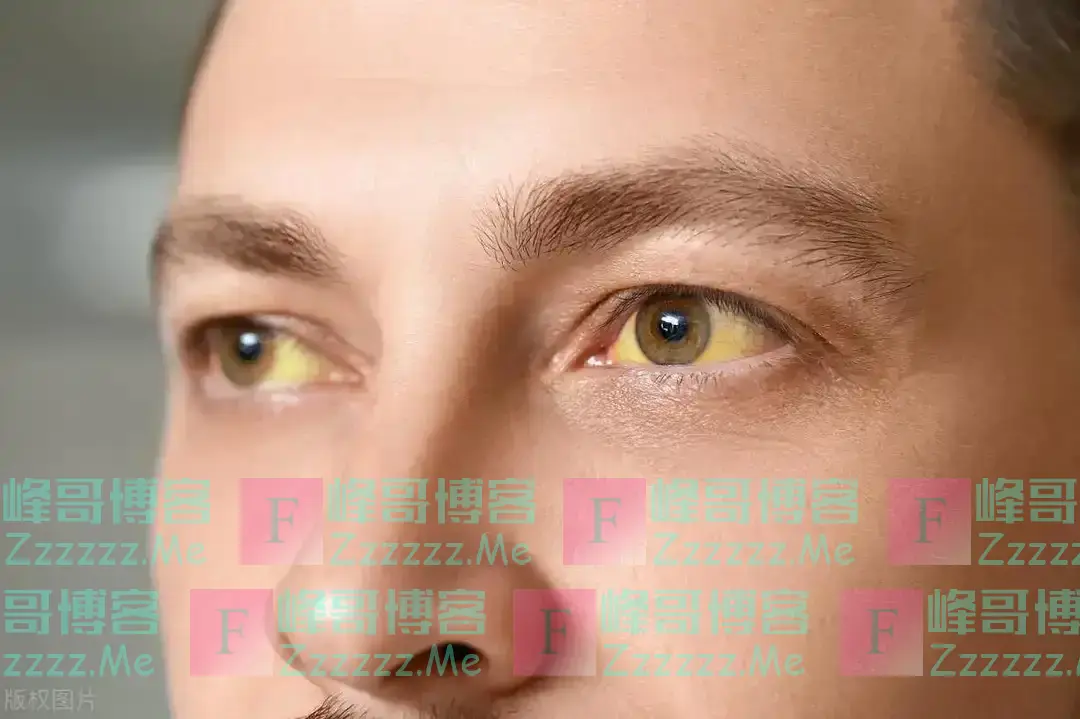 医生叮嘱：马上停止饮用这类茶叶，伤肝是烟酒的15倍，赶紧停下