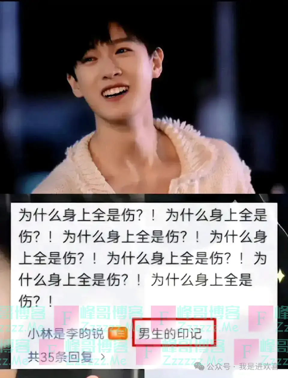 李昀锐被扇35个耳光、肌腱砍断汗水混着血水，哪有选择全是争取！