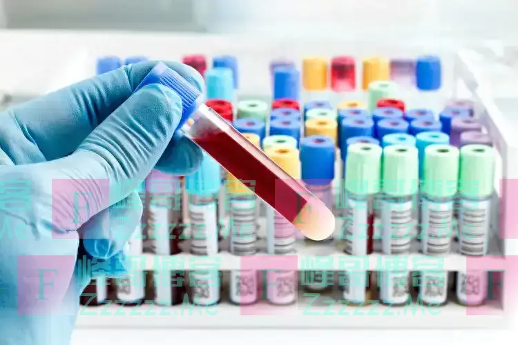 血型决定寿命长短？60万人研究发现：A型血或“天生”更易中风